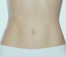 sculpsure-body-contouring